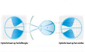 De anatomie van het oog beïnvloedt de optische perceptie van het brillenglas op het netvlies
